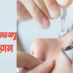 চোখের কতগুলো সাধারণ সমস্যা ও তার ঘরোয়া প্রতিকার 4f1750333d46