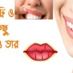 দাঁত, মাঢ়ি ও মুখের কিছু সমস্যা ও তার প্রতিকার fd6505bf6703