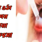 চোখ ওঠা রোগের ঘরোয়া চিকিৎসা চোখ-ওঠা-রোগের-ঘরোয়া-চিকিৎসা