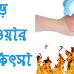 পুড়ে গেলে করনীয় বা পুড়ে যাওয়ার চিকিৎসা পুড়ে-যাওয়ার-চিকিৎসা